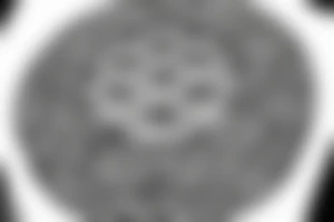 A big round mandala covering the shoulder implementing the flower of life tattoo idea