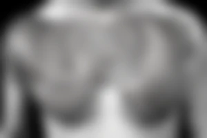 greek themed chest piece covering whole of chest tattoo idea