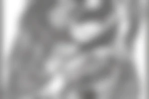 A Whale whos Belly Portraits Gustav Klimt Virgins Or mermaid tattoo idea